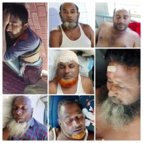 সোনাতলায় জমিতে হালচাষ নিয়ে দুই পক্ষের সংঘর্ষে আহত ৮